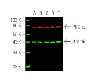 Simultaneous direct near-infrared western blot analysis of PKC &alpha; expression, detected... 