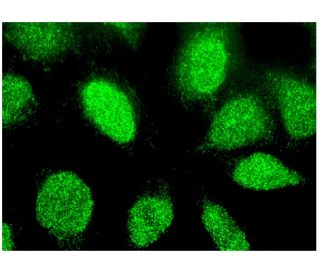 bovine anti-goat IgG-CFL 488: sc-362254. Immunofluorescence staining of methanol-fixed HeLa cells showing nuclear localiza 