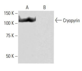 Cryopyrin/NALP3/NLRP3 Antibody (6F12) - Western Blotting - Image 64900