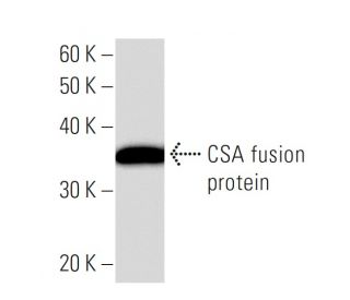 CSA Antibody (235C3a) - Western Blotting - Image 16607