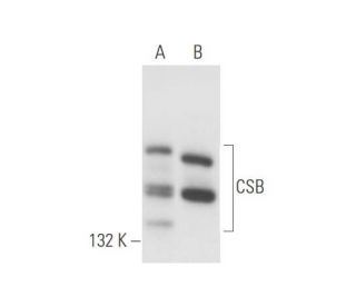 CSB Antibody (B-10) - Western Blotting - Image 57044 
