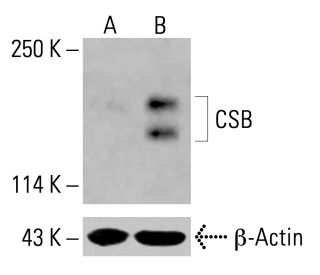 CSB Antibody (E-6) - Western Blotting - Image 415369 