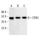 CSN3 Antibody (RR12) - Western Blotting - Image 412741