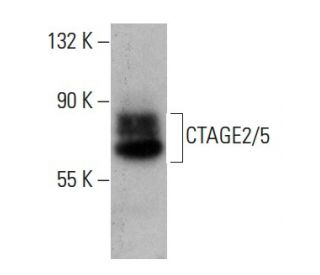 CTAGE2/5 Antibody (F-5) - Western Blotting - Image 139407 