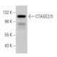 CTAGE2/5 Antibody (F-5) - Western Blotting - Image 366546