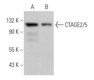 CTAGE2/5 Antibody (B-1) - Western Blotting - Image 366542