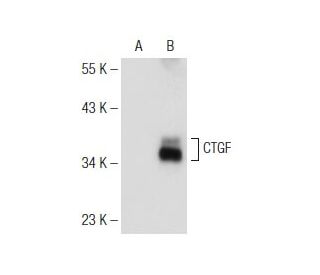CTGF Antibody (E-5) - Western Blotting - Image 146318