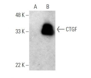 CTGF (E-5) HRP: sc-365970 HRP. Direct western blot analysis of... 