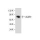 ACAP2 Antibody (F-8) - Western Blotting - Image 154593 