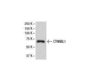 CTNNBL1 Antibody (S5) - Western Blotting - Image 33442 