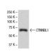CTNNBL1 Antibody (S5) - Western Blotting - Image 33442 