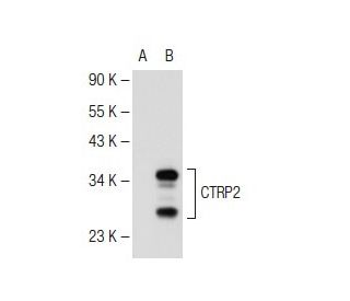 CTRP2 Antibody (10B8) - Western Blotting - Image 109409 