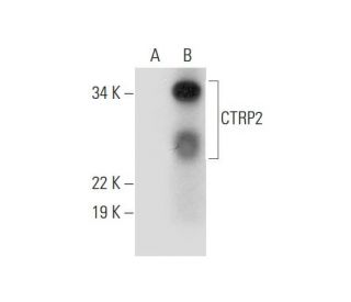 CTRP2 Antibody (B-3) - Western Blotting - Image 290891