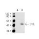 CTXL Antibody (ICO-44) - Western Blotting - Image 67158
