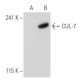 CUL-7 Antibody (AB13) - Western Blotting - Image 33239