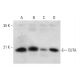 CUTA Antibody (H-8) - Western Blotting - Image 309583 