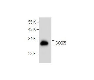 CXXC5 Antibody (H-6) - Western Blotting - Image 155277The Double Nickase Plasmid features a U6 promoter for sgRNA expression, a 20 nt targeting sequence, and a gRNA scaffold to guide Cas9n. It includes a CBh promoter for Cas9n (D10A) and puromycin resistance, GFP for transfection verification, and nuclear localization signals (NLS). The 2A peptide allows co-expression of Cas9n and Puro from a single promoter, enabling precise genome editing with reduced off-target effects.