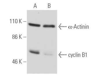 cyclin B1 siRNA (h): sc-29284. Western blot analysis of cyclin B1 expression in non-transfected control (A) and cyclin B1 