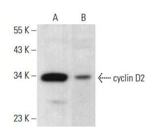 cyclin D2 Antibody (34B1-3) - Western Blotting - Image 379652 