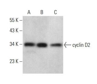 cyclin D2 Antibody (DCS-5) - Western Blotting - Image 377433 