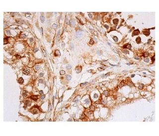 cyclin E Antibody (HE12) - Immunohistochemistry - Image 352282 
