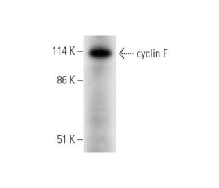 cyclin F Antibody (B-6) - Western Blotting - Image 344561The Double Nickase Plasmid features a U6 promoter for sgRNA expression, a 20 nt targeting sequence, and a gRNA scaffold to guide Cas9n. It includes a CBh promoter for Cas9n (D10A) and puromycin resistance, GFP for transfection verification, and nuclear localization signals (NLS). The 2A peptide allows co-expression of Cas9n and Puro from a single promoter, enabling precise genome editing with reduced off-target effects.