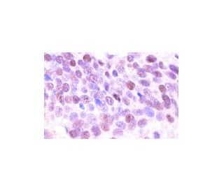 cyclin G1 Antibody (F-5) - Immunohistochemistry - Image 555 