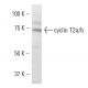 cyclin T2a/b Antibody (2128C1a) - Western Blotting - Image 16525 