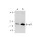 Cyclopamine: sc-200929. Western blot analysis of p21 expression in untreated (A) and Cyclopamine treated (B) SW480 whole c