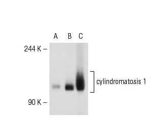 cylindromatosis 1 Antibody (E-10) - Western Blotting - Image 50891 