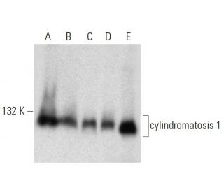 cylindromatosis 1 Antibody (H-6) - Western Blotting - Image 320926 