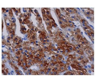 CYP17A1 Antibody (D-12) - Immunohistochemistry - Image 350189 