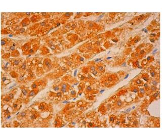 CYP17A1 Antibody (G-4) - Immunohistochemistry - Image 313945 