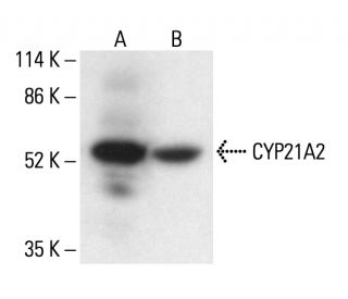 CYP21A2 Antibody (B-7) - Western Blotting - Image 411310The Double Nickase Plasmid features a U6 promoter for sgRNA expression, a 20 nt targeting sequence, and a gRNA scaffold to guide Cas9n. It includes a CBh promoter for Cas9n (D10A) and puromycin resistance, GFP for transfection verification, and nuclear localization signals (NLS). The 2A peptide allows co-expression of Cas9n and Puro from a single promoter, enabling precise genome editing with reduced off-target effects.