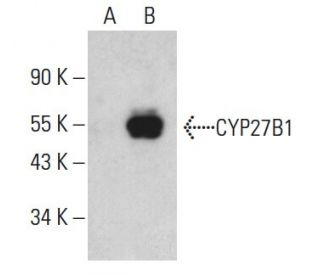 CYP27B1 Antibody (E-7) - Western Blotting - Image 396625 