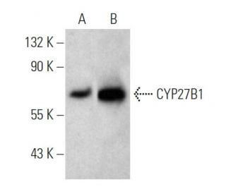 CYP27B1 Antibody (G-5) - Western Blotting - Image 374537The Double Nickase Plasmid features a U6 promoter for sgRNA expression, a 20 nt targeting sequence, and a gRNA scaffold to guide Cas9n. It includes a CBh promoter for Cas9n (D10A) and puromycin resistance, GFP for transfection verification, and nuclear localization signals (NLS). The 2A peptide allows co-expression of Cas9n and Puro from a single promoter, enabling precise genome editing with reduced off-target effects.