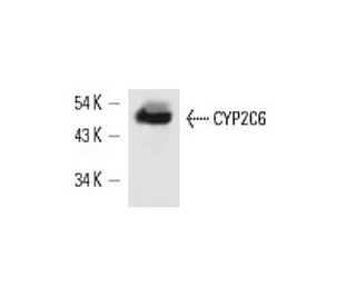CYP2C6 Antibody (K1) - Western Blotting - Image 13649 