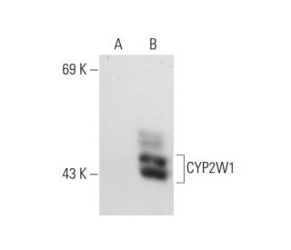 CYP2W1 (G-11): sc-166331. Western blot analysis of CYP2W1 expression in...