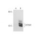 CYP2W1 (G-11): sc-166331. Western blot analysis of CYP2W1 expression in...