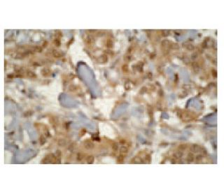 CYP3A7 Antibody (F19 P2 H2) - Immunohistochemistry - Image 47823 