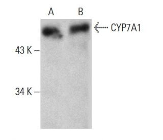 CYP7A1 Antibody (E-10) - Western Blotting - Image 387987 