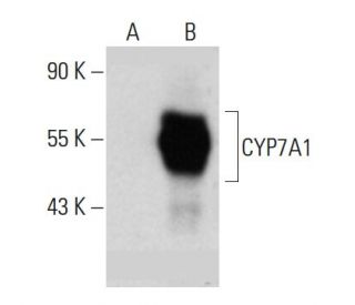 CYP7A1 Antibody (E-10) - Western Blotting - Image 385348Each CRISPR/Cas9 Knockout (KO) Plasmid product consists of a pool of 3 plasmids designed to ensure identification and cleavage of a specific gene for maximum knockout efficiency. Each plasmid encodes a unique 20 nt sequence derived from the GeCKO (v2) library. 