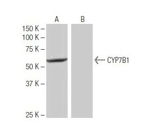 CYP7B1 Antibody (WW-H9) - Western Blotting - Image 64903