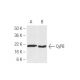 这种多克隆抗体已经停产。请参阅我们推荐的<a href="cypb-antibody-k2e2">CyPB (k2E2)</a>单克隆抗体(显示样本数据)。 western blotting image from recommended CyPB (k2E2) monoclonal antibody replacement. Image 47892