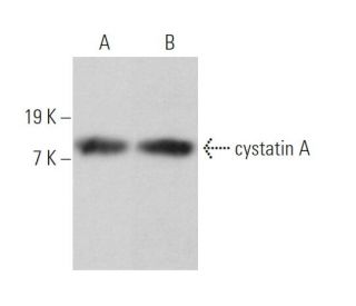 cystatin A Antibody (B-11) - Western Blotting - Image 364432 