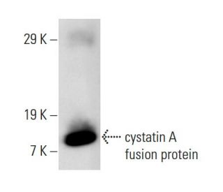 cystatin A Antibody (WR23/2/3) - Western Blotting - Image 11053
