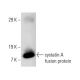 cystatin A Antibody (WR23/2/3) - Western Blotting - Image 11053