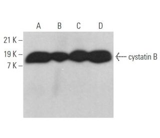 cystatin B Antibody (6A7) - Western Blotting - Image 372920 