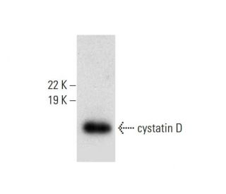 cystatin D Antibody (F-3) - Western Blotting - Image 305775The Double Nickase Plasmid features a U6 promoter for sgRNA expression, a 20 nt targeting sequence, and a gRNA scaffold to guide Cas9n. It includes a CBh promoter for Cas9n (D10A) and puromycin resistance, GFP for transfection verification, and nuclear localization signals (NLS). The 2A peptide allows co-expression of Cas9n and Puro from a single promoter, enabling precise genome editing with reduced off-target effects.