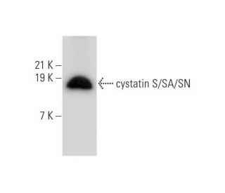cystatin S/SA/SN Antibody (Z8983) - Western Blotting - Image 333861